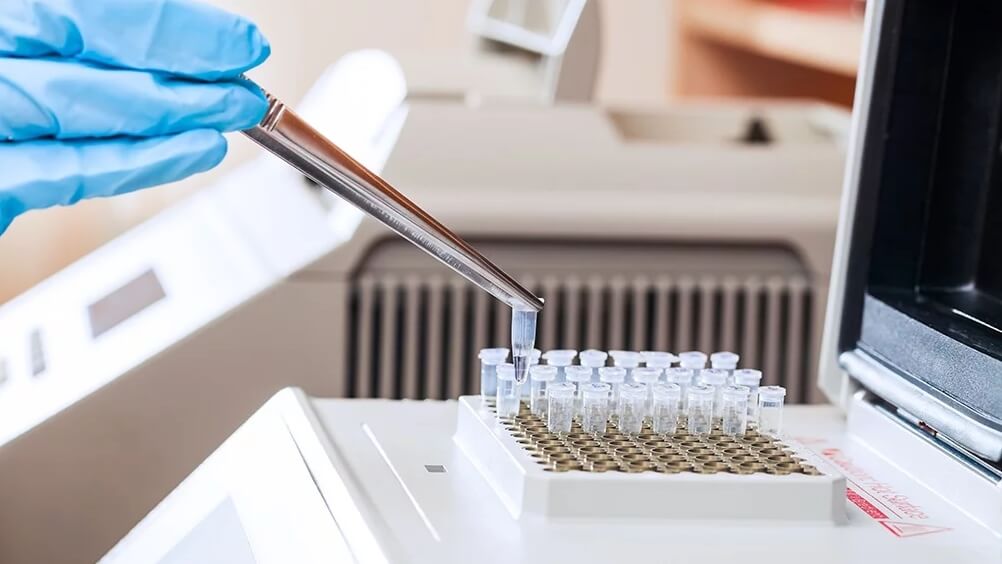 GlaxoSmithKline and 23andMe Look To Improve The Future Of Pharma With Genomics – August 2018 Healthcare Hot Takes